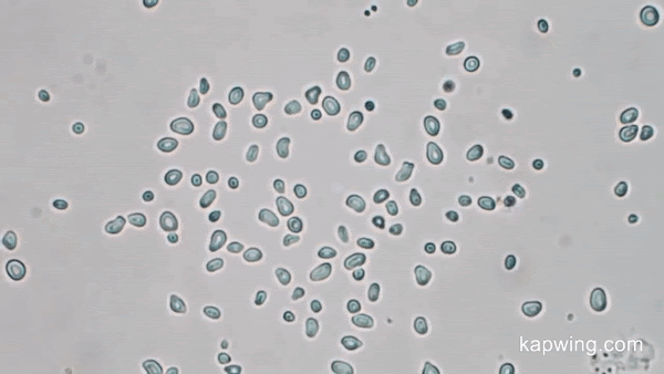 Pollen grains in water viewed under a microscope jiggle due to small fluctuations in the pressure of the surrounding fluid, a phenomenon known as Brownian Motion